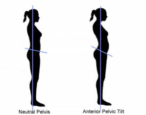 Posture diagram